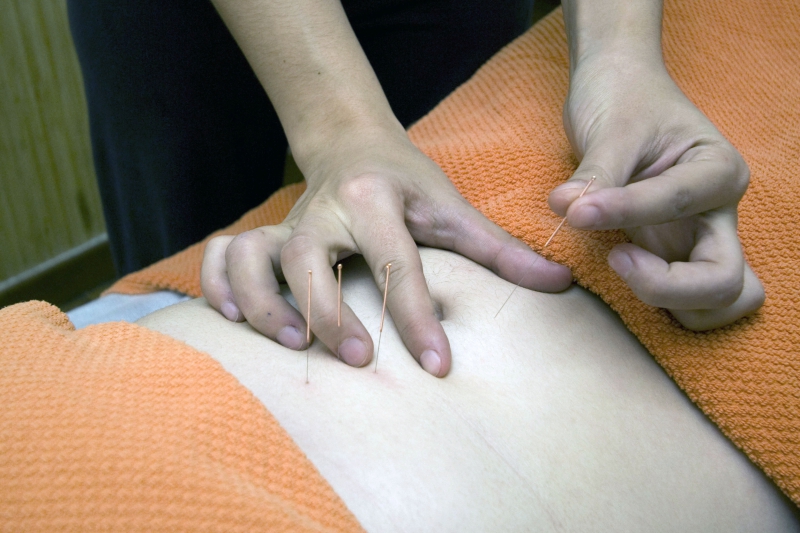 osteopathe-LES SALLES SUR VERDON-min_acupuncture-4175625